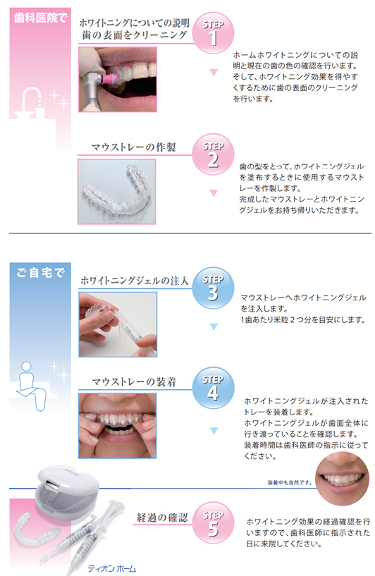 ホームホワイトニングのステップ